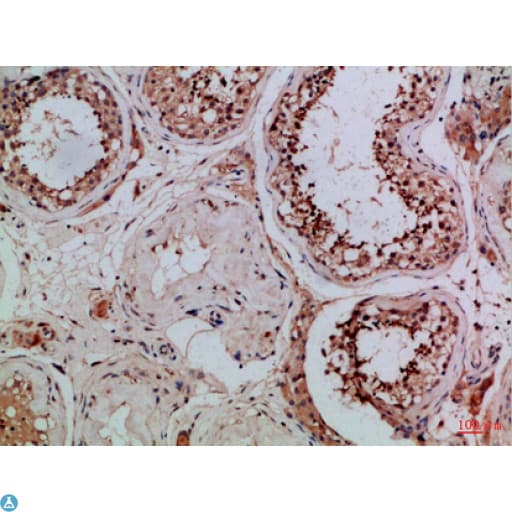 Tubulin Gamma Antibody