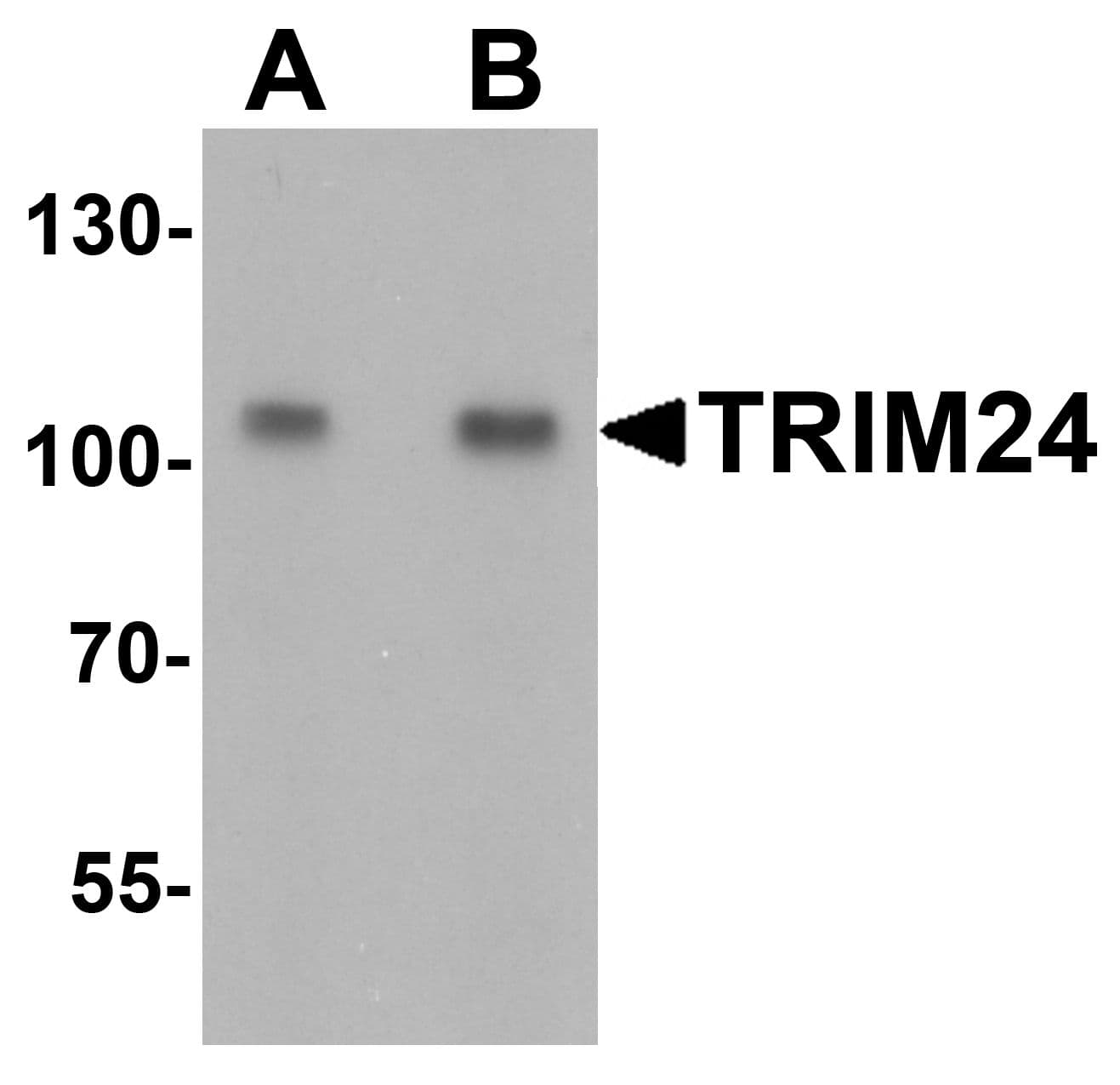 IHC-plus™ TRIM24 / TIF1 Antibody
