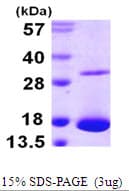 Human CLC Protein (Recombinant His)