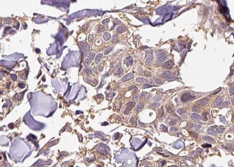 NFKB1 / NF-Kappa-B Antibody (phospho-Ser927)