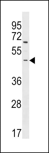 Polyclonal Rabbit anti-Human ARHGEF35 Antibody (aa248-275, WB)