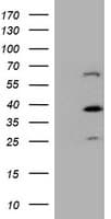 Monoclonal Mouse anti-Human DTNB / Dystrobrevin Beta Antibody (clone OTI2E6, IHC, WB)