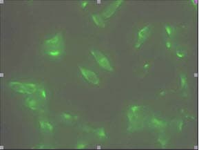 IHC-plus™ Monoclonal Mouse anti-Human STEAP1 / STEAP Antibody (clone J2D2, aa1-70, IHC, IF, WB)