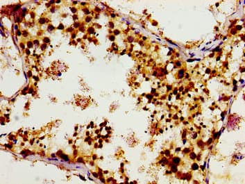 TUBGCP4 Antibody