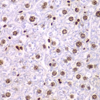 Polyclonal Rabbit anti-Human FACT / SSRP1 Antibody (IHC, IF, WB)