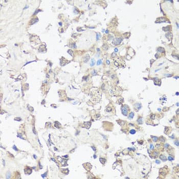MAP1LC3B / LC3B Antibody