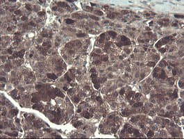 TSC22D1 / TSC22 Antibody (clone OTI3B7)