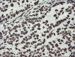 NONO / P54NRB Antibody (aa184-385, clone OTI5F1)
