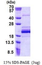 Human BUD31 Protein (Recombinant His)