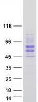 Human SIGIRR Protein (Recombinant Myc-DDK (Flag))