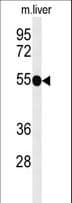 Polyclonal Rabbit anti-Human CD30 Antibody (aa458-487, IHC, WB)