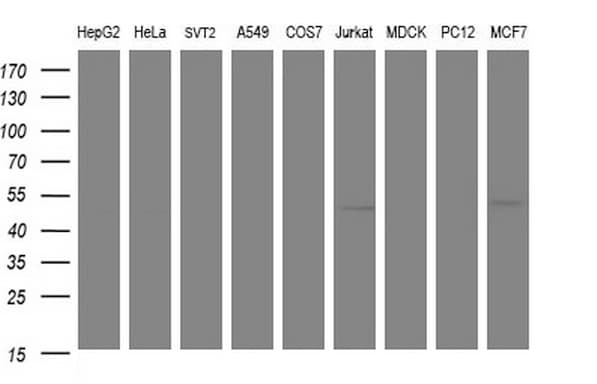 ANKMY2 Antibody (clone OTI2G1)