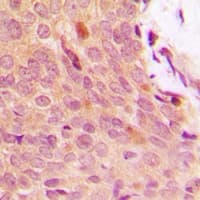 NFKBIA / IKB Alpha / IKBA Antibody (N-Terminus)