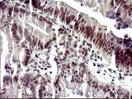 ATXN7L1 Antibody (clone OTI4F6)