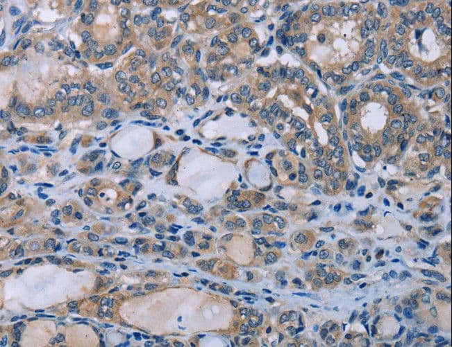 HOMER1 / Homer 1 Antibody