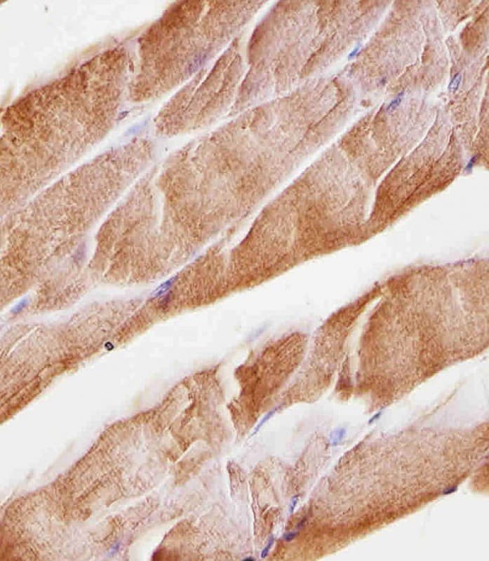 MUSK Antibody (clone 1429CT456.173.44)