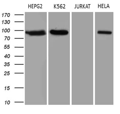 TOP1 / Topoisomerase I Antibody (aa93-151, clone OTI3B9)