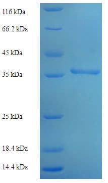 Human AK1 / Adenylate Kinase 1 Protein (Recombinant His-SUMO)