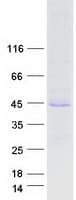 Human HPS / HPS1 Protein (Recombinant Myc-DDK (Flag))