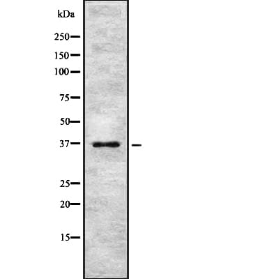 PINX1 Antibody