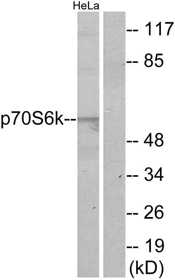 Polyclonal Rabbit anti-Human RPS6KB1 / P70S6K / S6K Antibody (aa414-463, IHC, WB)