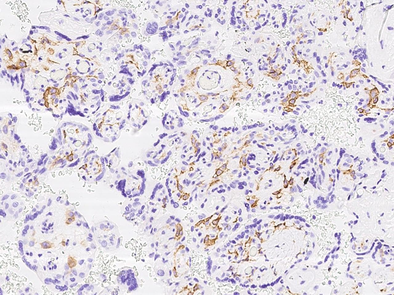 FBP / FOLR2 Antibody (Preservative Free)