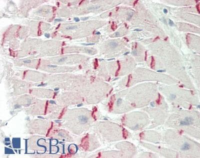IHC-plus™ CDH2 / N Cadherin Antibody