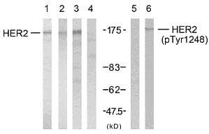 ERBB2 / HER2 Antibody (p1248)