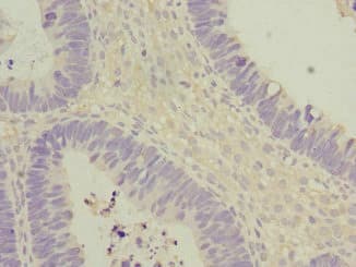 Polyclonal Rabbit anti-Human EIF2B2 Antibody (IHC)