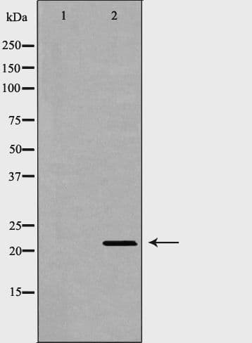 SDC2 / Syndecan 2 Antibody