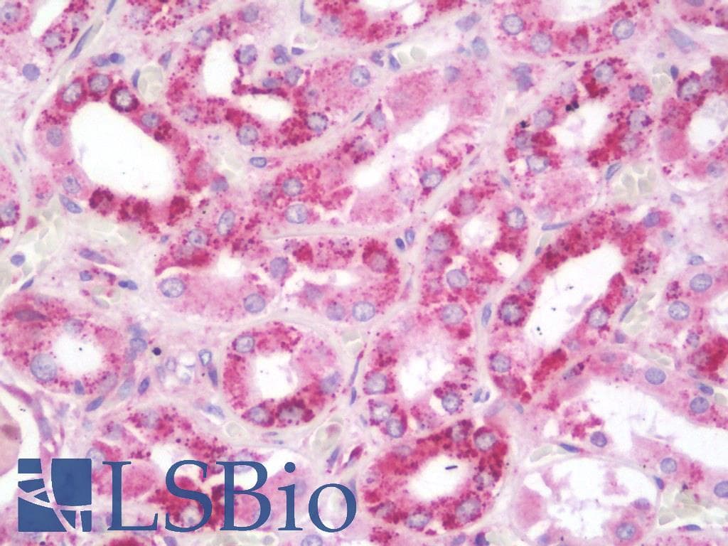 IHC-plus™ PTCH1 / Patched 1 Antibody (Cytoplasmic Domain)