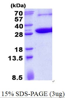 Human KCTD5 Protein (Recombinant His)