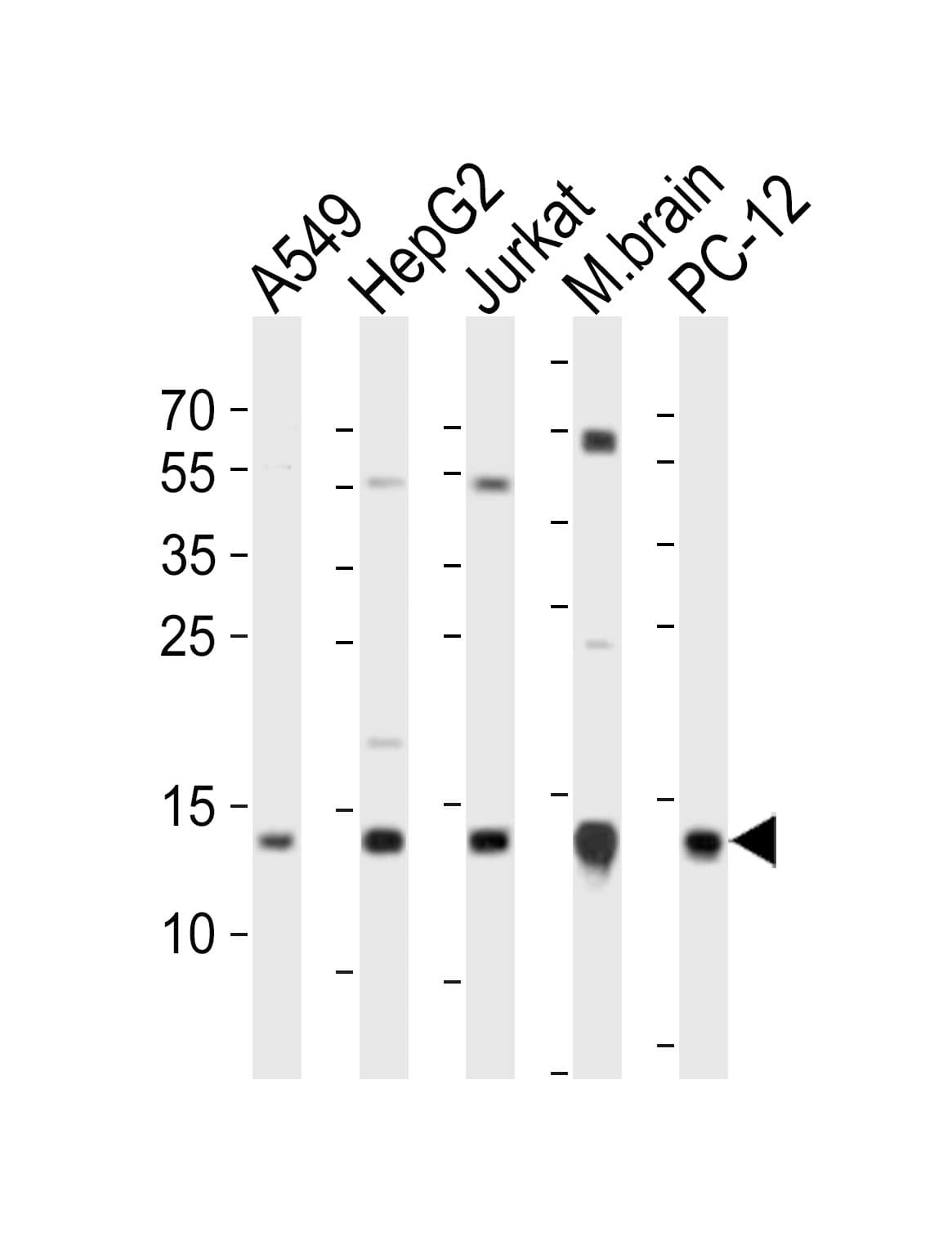 ATP5D Antibody (aa156-188)