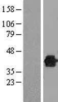 DUSP12 Protein (Over-Expression Lysate Myc-DDK (Flag))