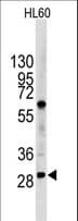IHC-plus™ Polyclonal Rabbit anti-Human LIN28B Antibody (aa1-30, IHC, IF, WB)