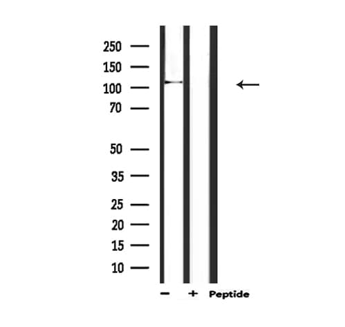 Polyclonal Rabbit anti-Human BMPR2 Antibody (IF, WB)