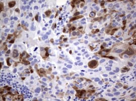 Monoclonal Mouse anti-Human TS / Thymidylate Synthase Antibody (clone OTI1B1, IHC, WB)