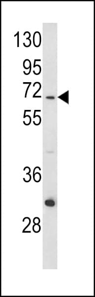 IHC-plus™ Polyclonal Rabbit anti-Human MT-ND5 Antibody (aa544-570, IHC, WB)