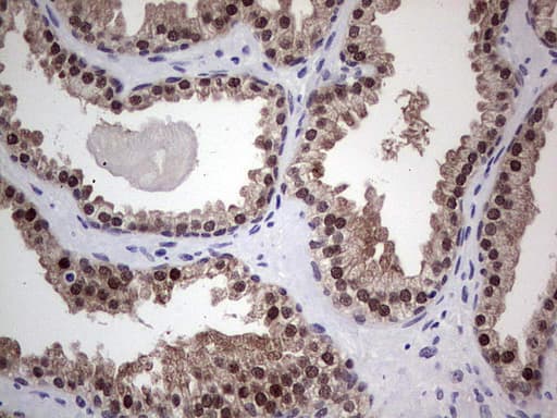 Monoclonal Mouse anti-Human RAD23B / HR23B Antibody (clone OTI7G10, aa1-253, IHC, WB)