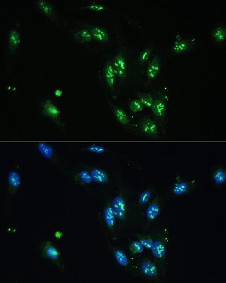 CCDC59 Antibody