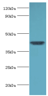 ACTR1A / Centractin Antibody (aa187-376)