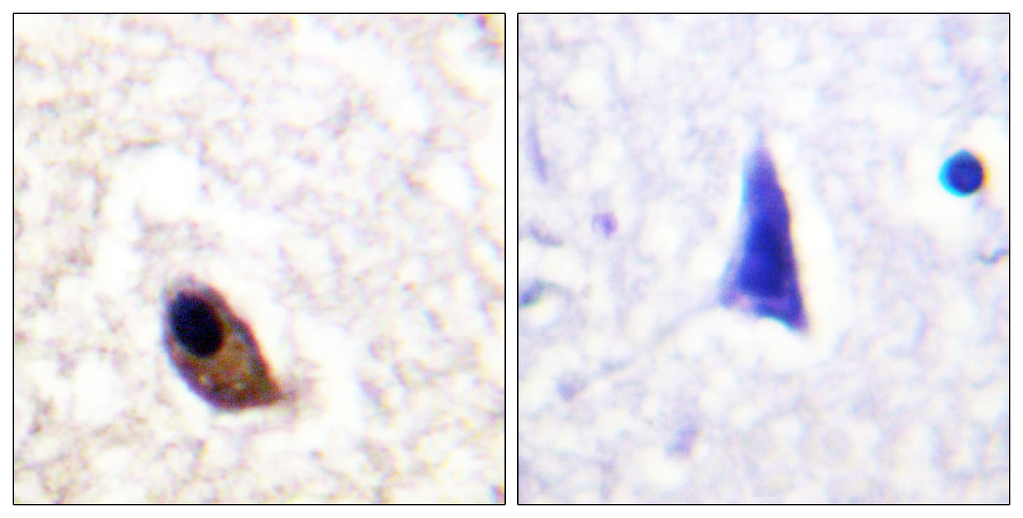 GRIN2A+GRIN2B Antibody (phospho-Tyr1246/Tyr1252)