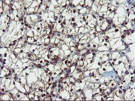 PPAT Antibody (aa42-278, clone OTI1B11)