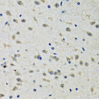 Polyclonal Rabbit anti-Human CLIC1 / NCC27 Antibody (IHC, IF, WB)