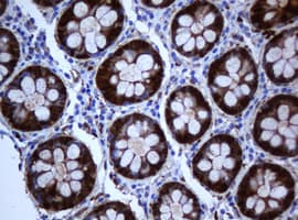 Selenium Binding Protein 1 Antibody (clone OTI3H1)