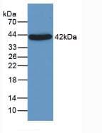 ORM1 / Orosomucoid Antibody (Biotin)