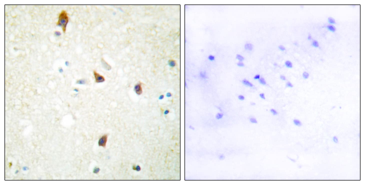 HTR2B / 5-HT2B Receptor Antibody (aa261-310)