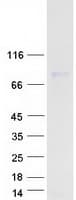 Human PKP1 / Plakophilin 1 Protein (Recombinant Myc-DDK (Flag))
