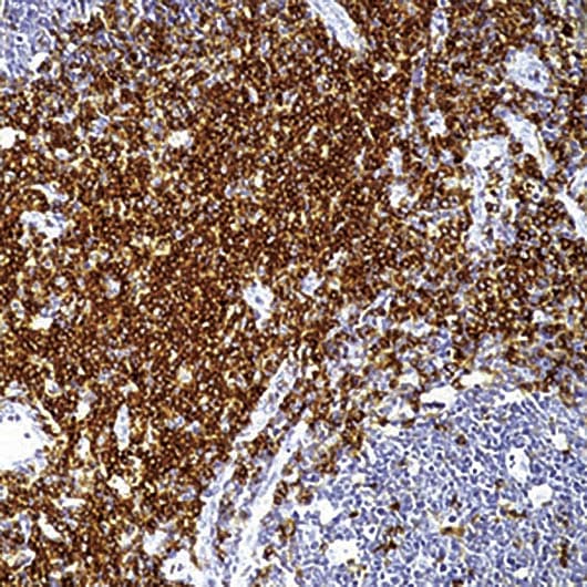SPN / CD43 Antibody (clone DF-T1)