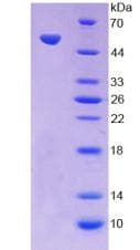 Human OSM / Oncostatin M Protein (Recombinant His-GST)